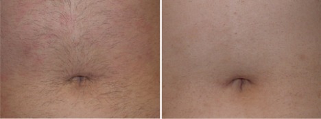 beforeafter-2