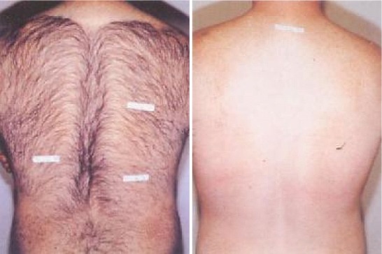 beforeafter-31